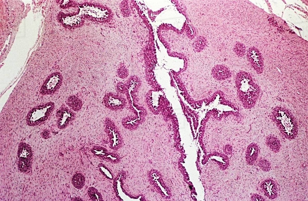 Breast tissue Stock Photo Dissolve