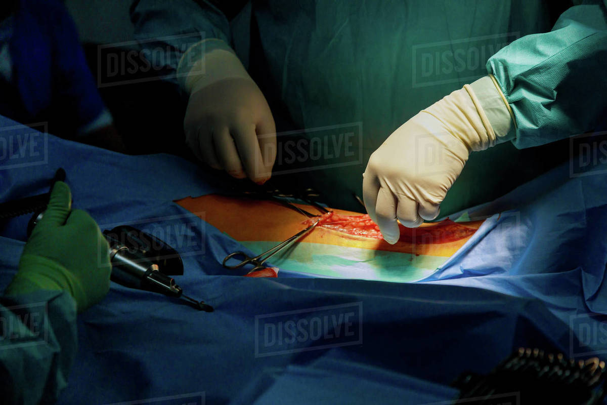 Surgeon makes deep incision with using electrical scalpel pencil to