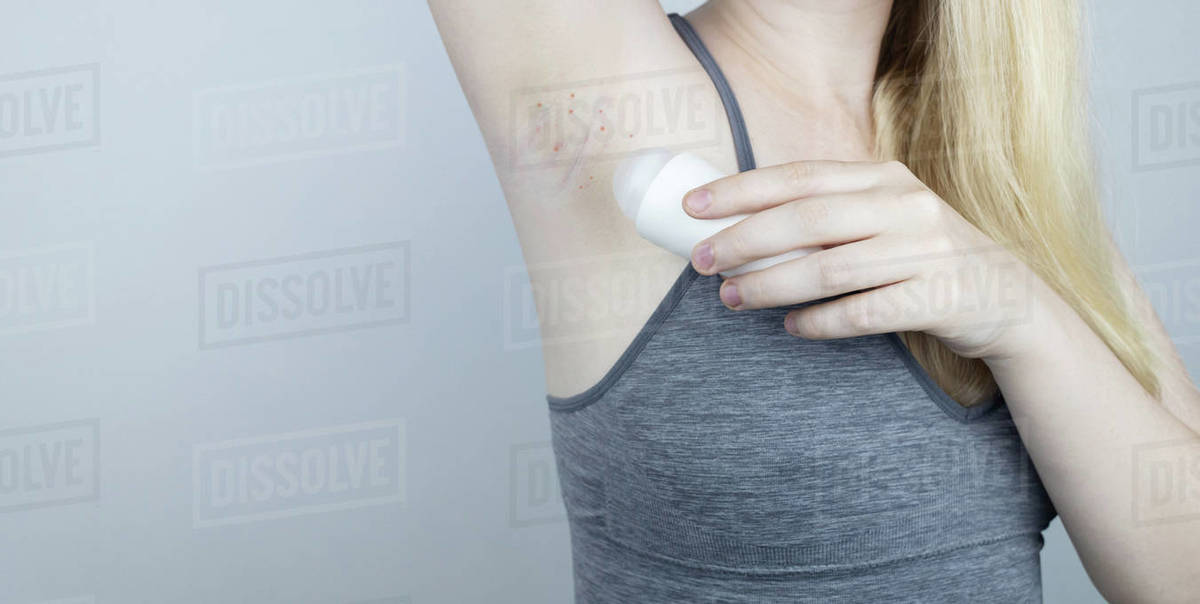 Armpit rash. Underarm skin irritation. Blonde girl shows irritation on