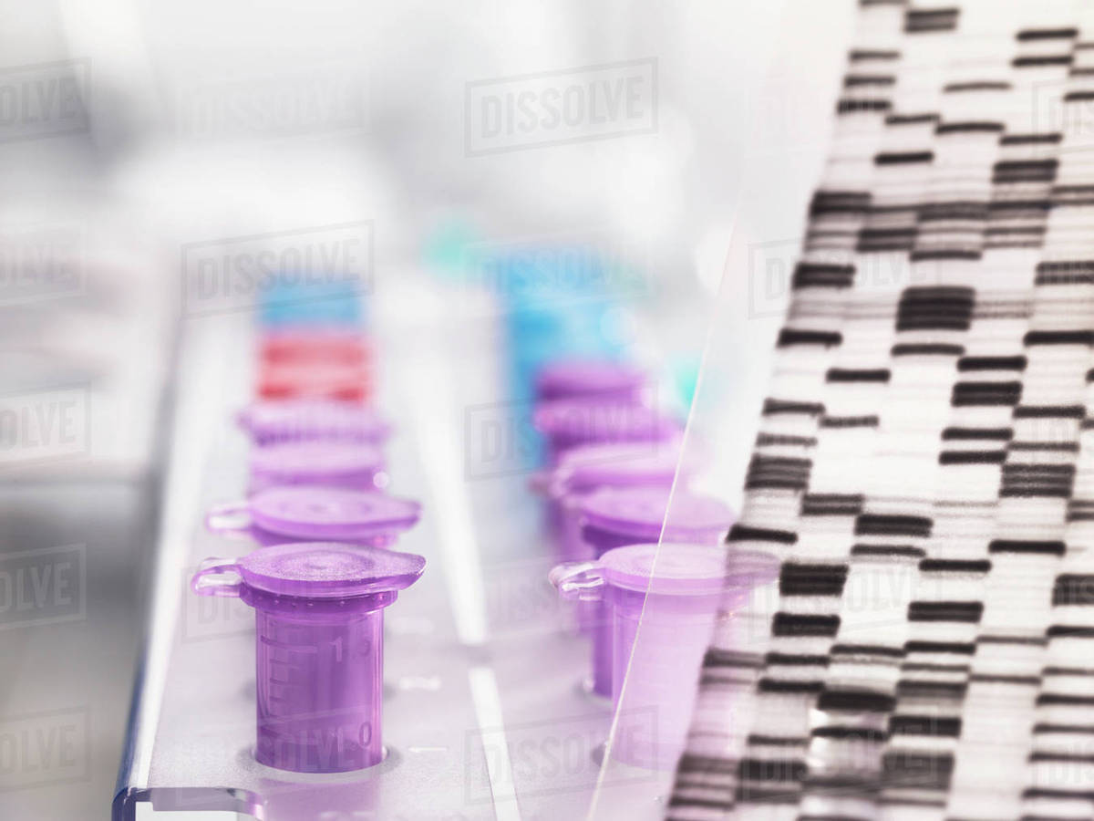 A DNA autoradiogram gel showing information with samples in