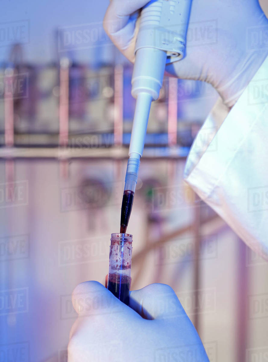 Scientist pipetting a sample in a lab setting - Stock Photo - Dissolve